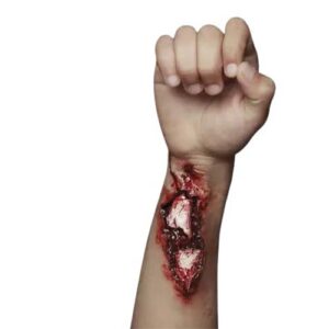 Protesis Latex Broken Arm