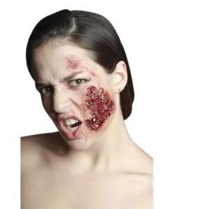 Protesis Latex Infected Itchy